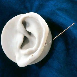 Acupunctuurnaalden met kopergreep (BB), zonder geleidebuisje, 0,35 x 50 mm, 100 stuks per pak
