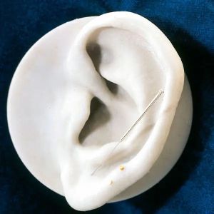 Acupunctuurnaalden met zilvergreep (BB)