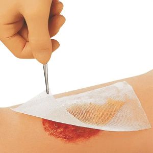 Cuticerin zalfgaas wondverband