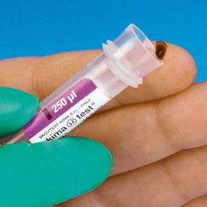 Pediatrisch bloedmonsterbuisje, 250 µl, met EDTA-coating, 20 x 50 stuks