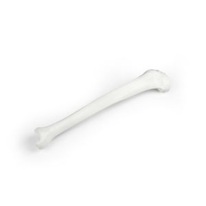 Tibia (scheenbeen), losse uitvoering