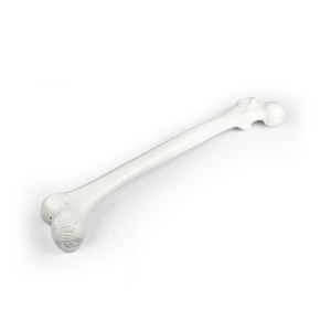 Femur (dijbeen), losse uitvoering