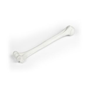 Humerus (opperarmbeen), losse uitvoering