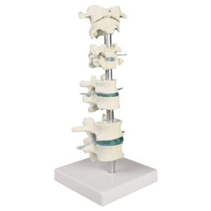 Wervelcollectie 8 stuks op standaard