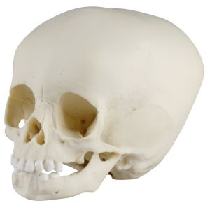 Kinderschedel, 15 maanden oud
