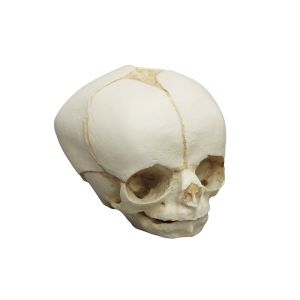 Foetale schedel, 30 weken