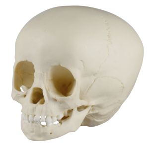 Kinderschedel, 1 ½ jaar oud