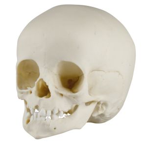 Kinderschedel, 14 maanden oud