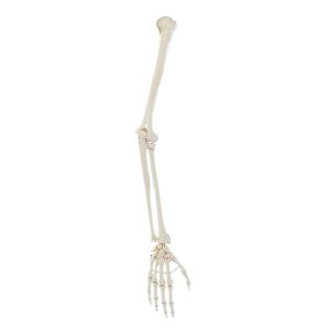 Armskelet (humerus, radius, ulna, hand)