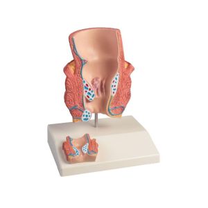 Aambeien model