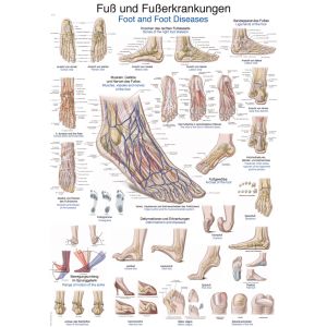 Anatomieposter "De voet en voetziekten", 50 x 70 cm