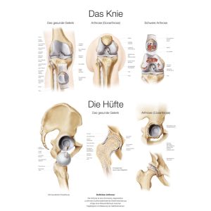 Anatomieposter "De knie en de heup", 50 x 70 cm