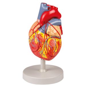 Hart met Bypass, 2 x levensgroot, 4 delen