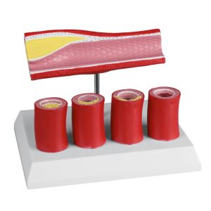 Slagader met 4 slagadersecties - EZ Augmented Anatomy
