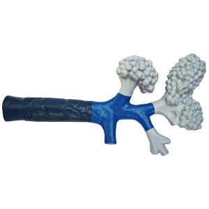 Bronchiolen