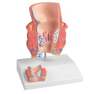Aambeien model