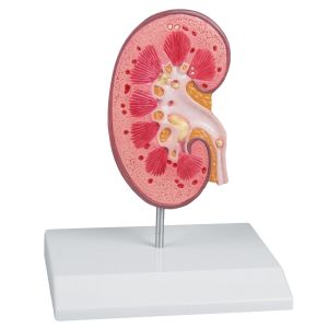 Niersteenmodel - EZ Augmented Anatomy