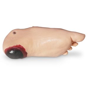 Decubitusvoet voor GERI/KERI
