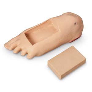 Oedeemvoet met diep weefselletsel voor GERI/KERI