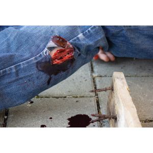 Wondmoulage 'Cut'