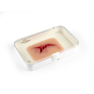 Wondmoulage 'laceratie'