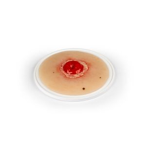 Wondmoulage ontstoken colostoma, zelfklevend