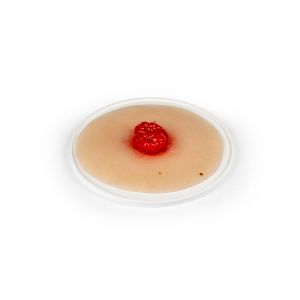Wondmoulage dubbelloops colostoma, zelfklevend