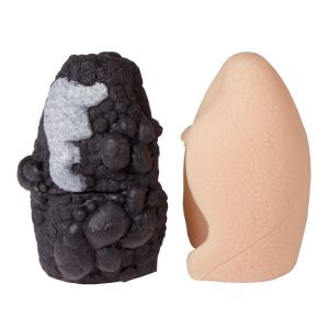 Vergelijkingsmodel voor longkanker