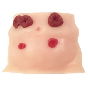 Stomazorgmodel