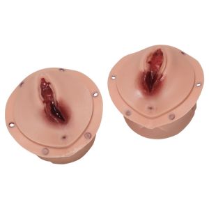 Postpartum episiotomie hechtingstrainer voor R 17860
