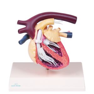 Hondenhart met hartworminfectie (Dirofilaria immitis)