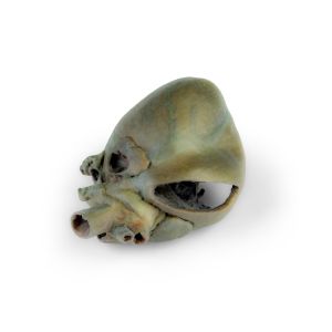 Hondenhart met dissectie