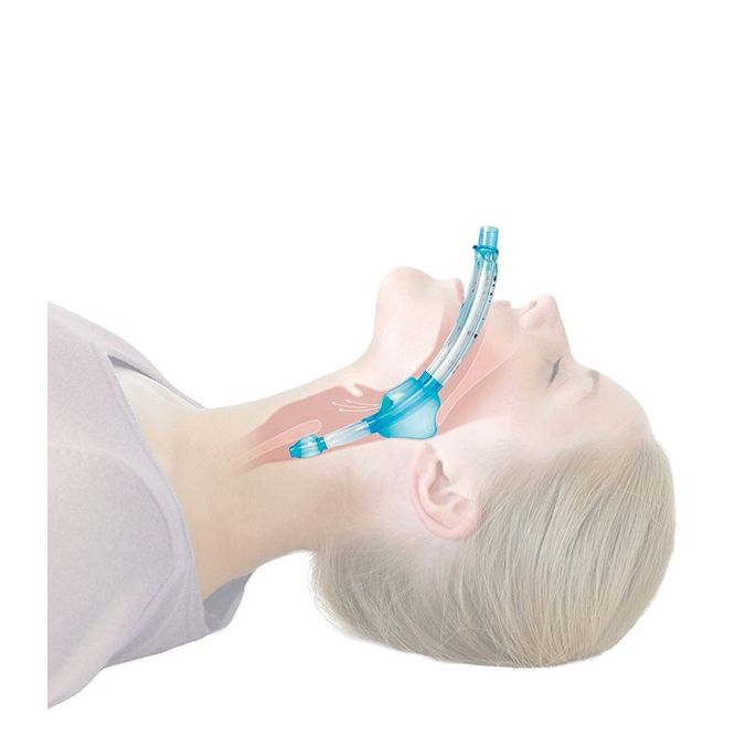 Intubatie-larynxtubus LT evo