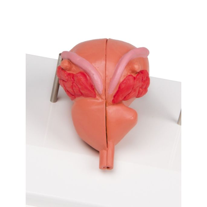 Prostaatmodel