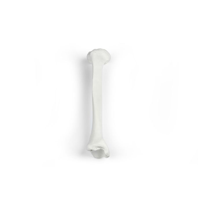 Tibia (scheenbeen)