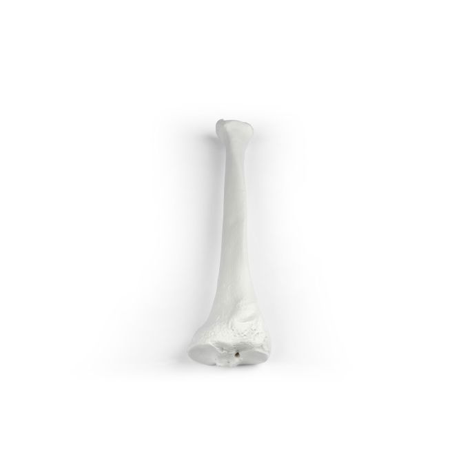 Tibia (scheenbeen)