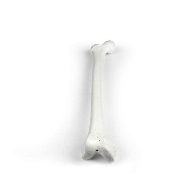 Femur (dijbeen)
