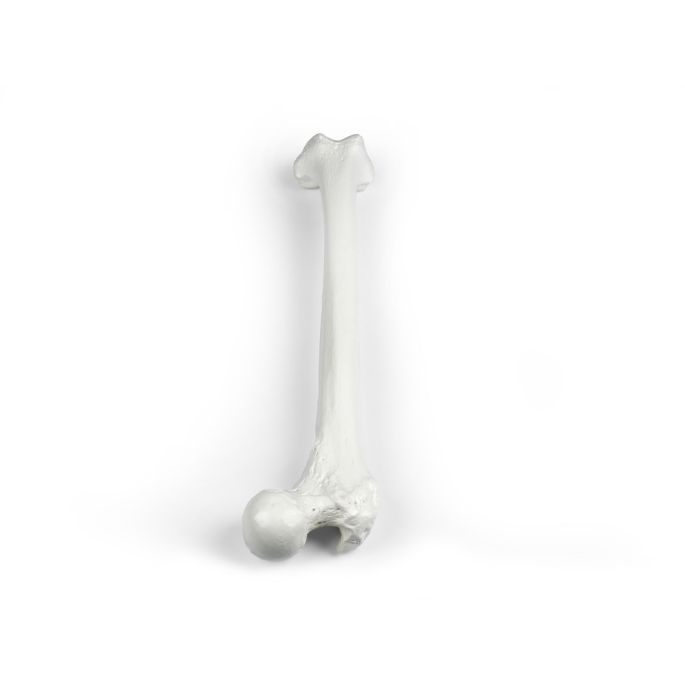 Femur (dijbeen)