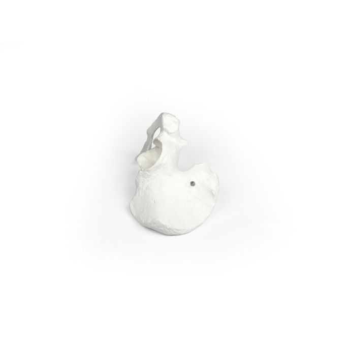 Hemipelvis (halve bekken)