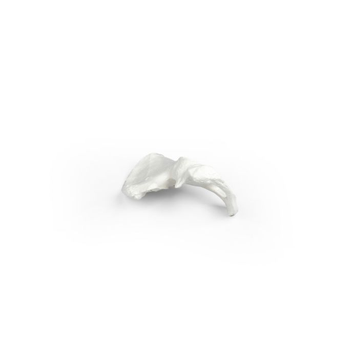 Hemipelvis (halve bekken)