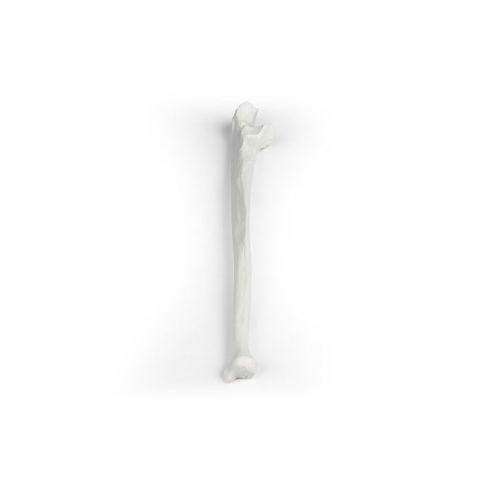 Ulna (ellepijp)