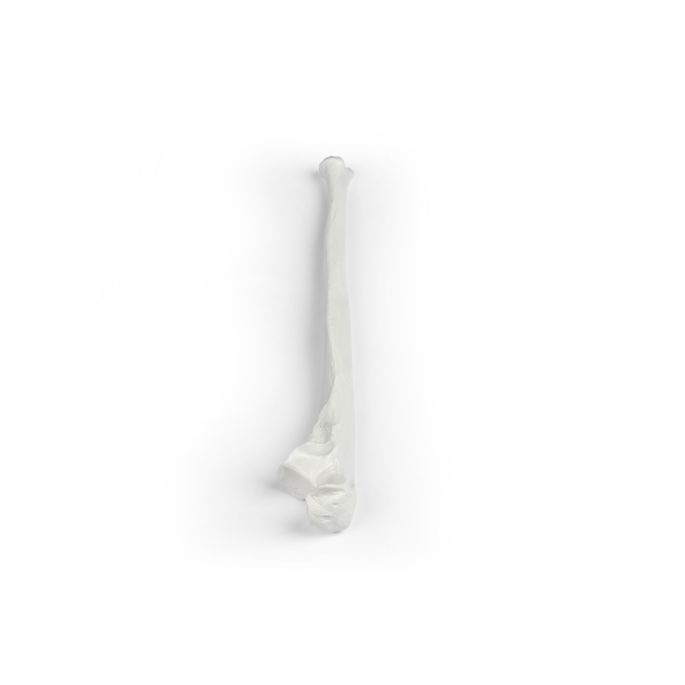 Ulna (ellepijp)
