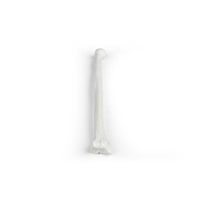 Radius (spaakbeen)