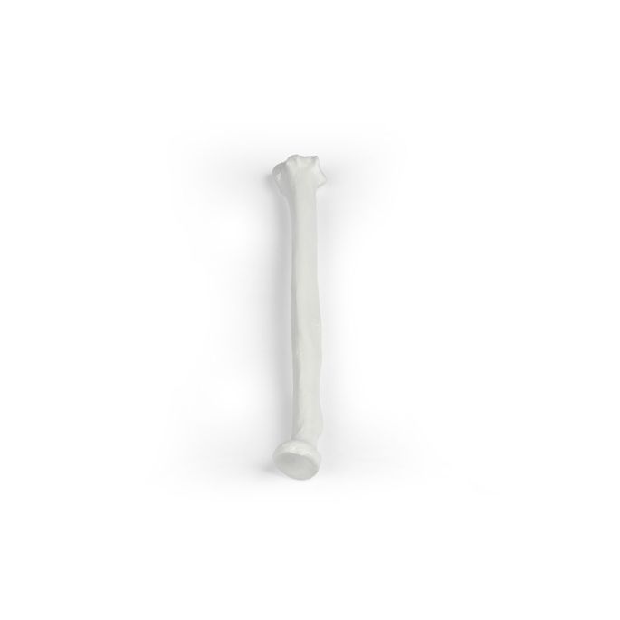 Radius (spaakbeen)