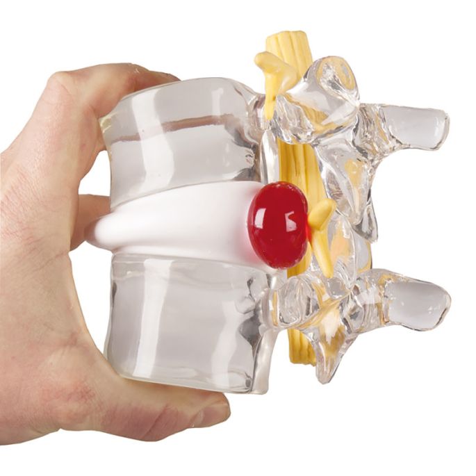 herniasimulator wervelkolom - afbeelding 2