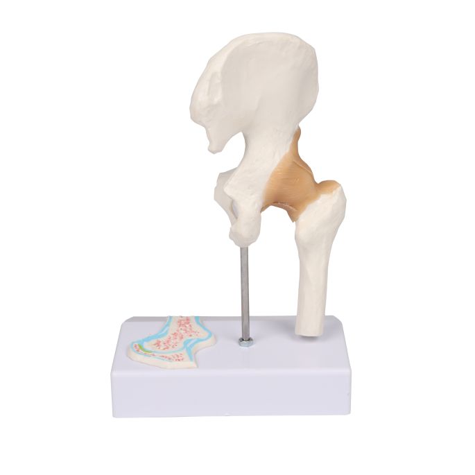 Miniatuur heupgewricht in dwarsdoorsnede - afbeelding 3