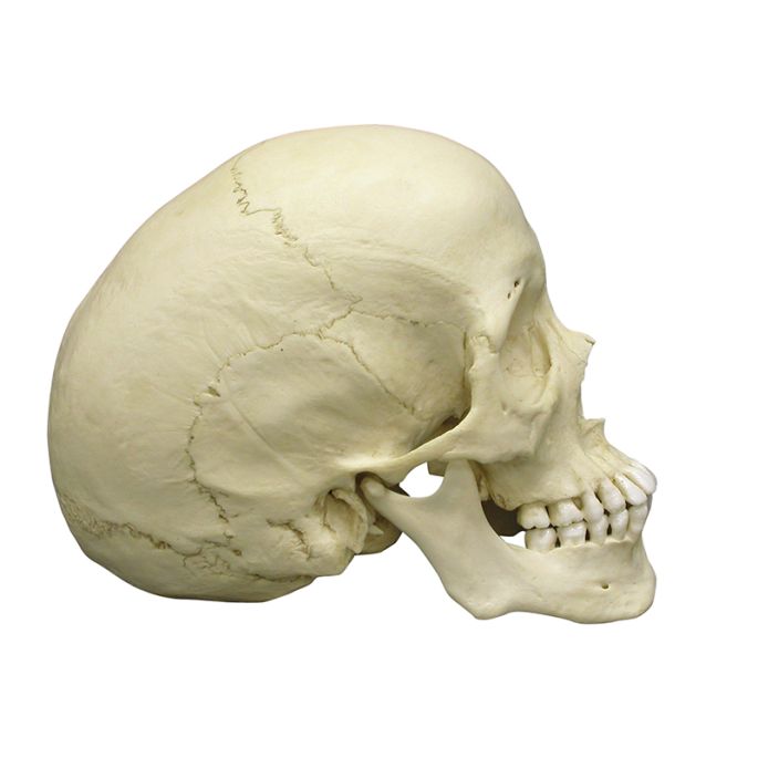 Scaphocephalische schedel