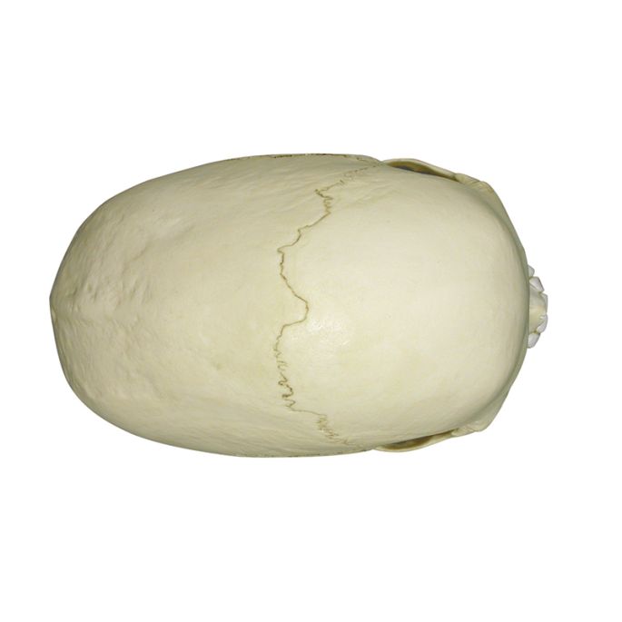 Scaphocephalische schedel