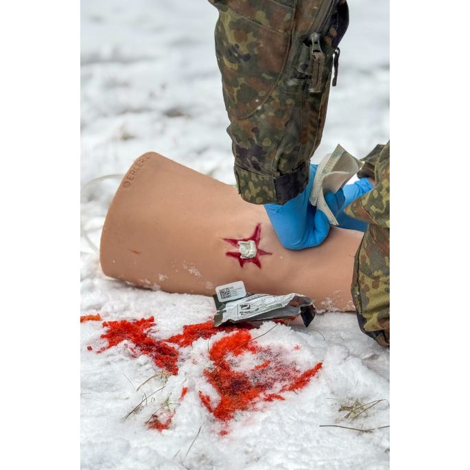 Trauma Tim, been met sterk bloedende wonden