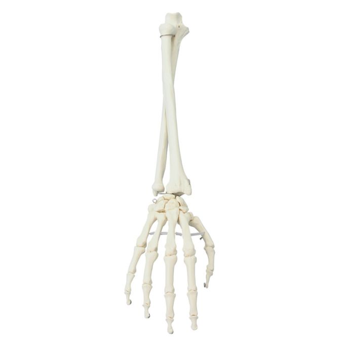 Hand met onderarm